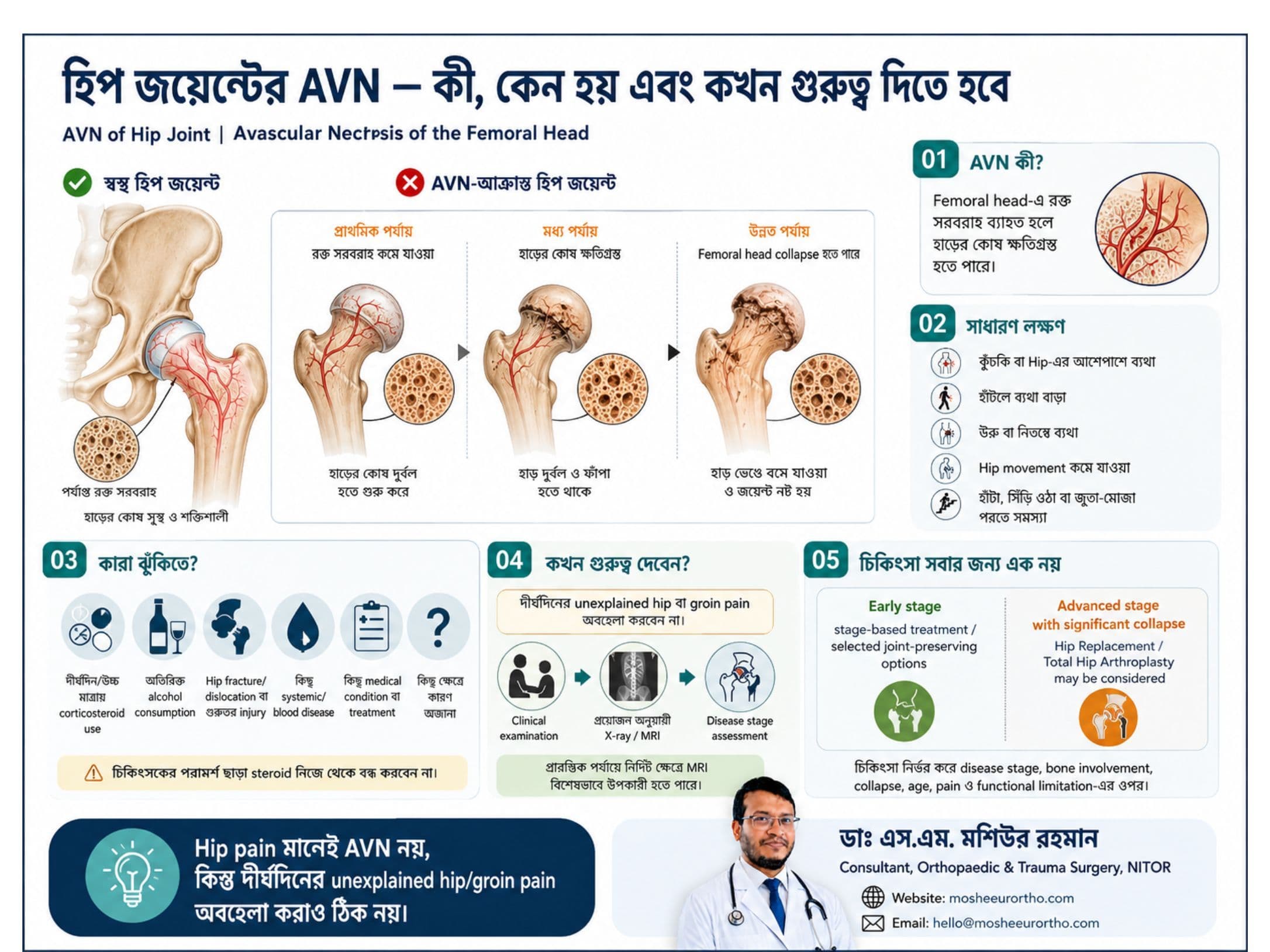 AVN of Hip Joint: লক্ষণ, কারণ, MRI ও চিকিৎসা